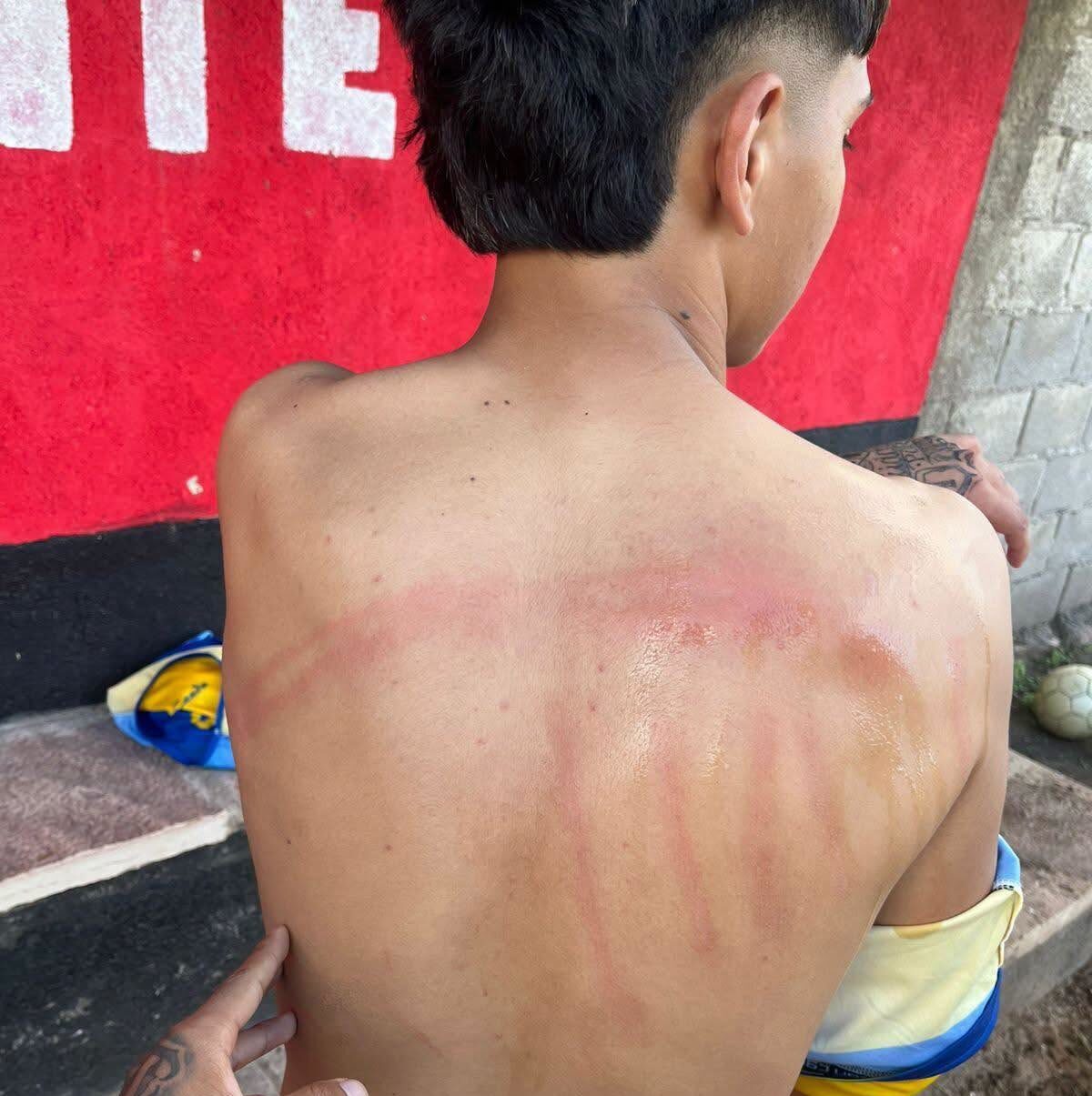 FÚTBOL:  LA AGRESIÓN A MAXI BAJINAY EN OLTA